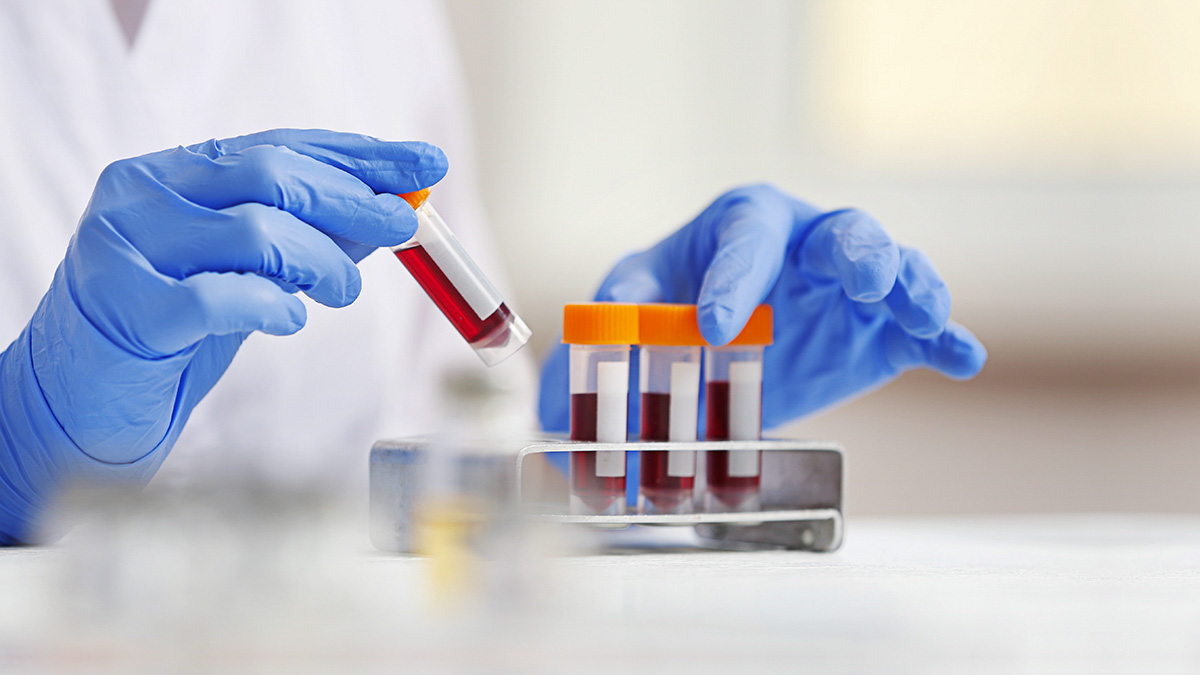 Woman Working With Blood Samples In Laboratory, Closeup